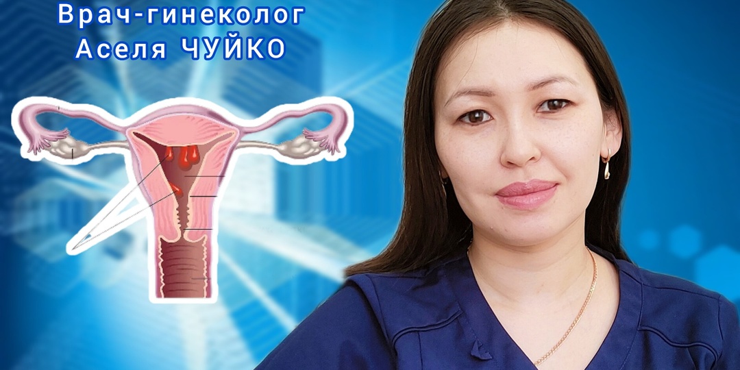 Полипы эндометрия: обязательно ли удалять? Рассказывает гинеколог Аселя ЧУЙКО