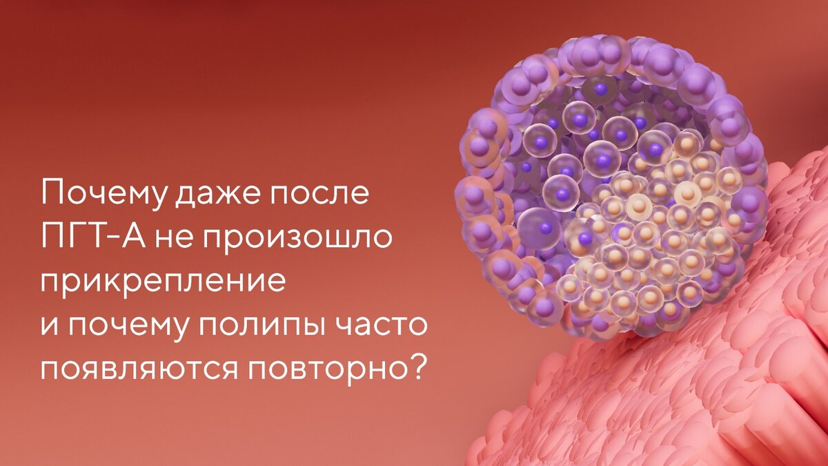Что такое пгт при эко. Что такое пгт при эко