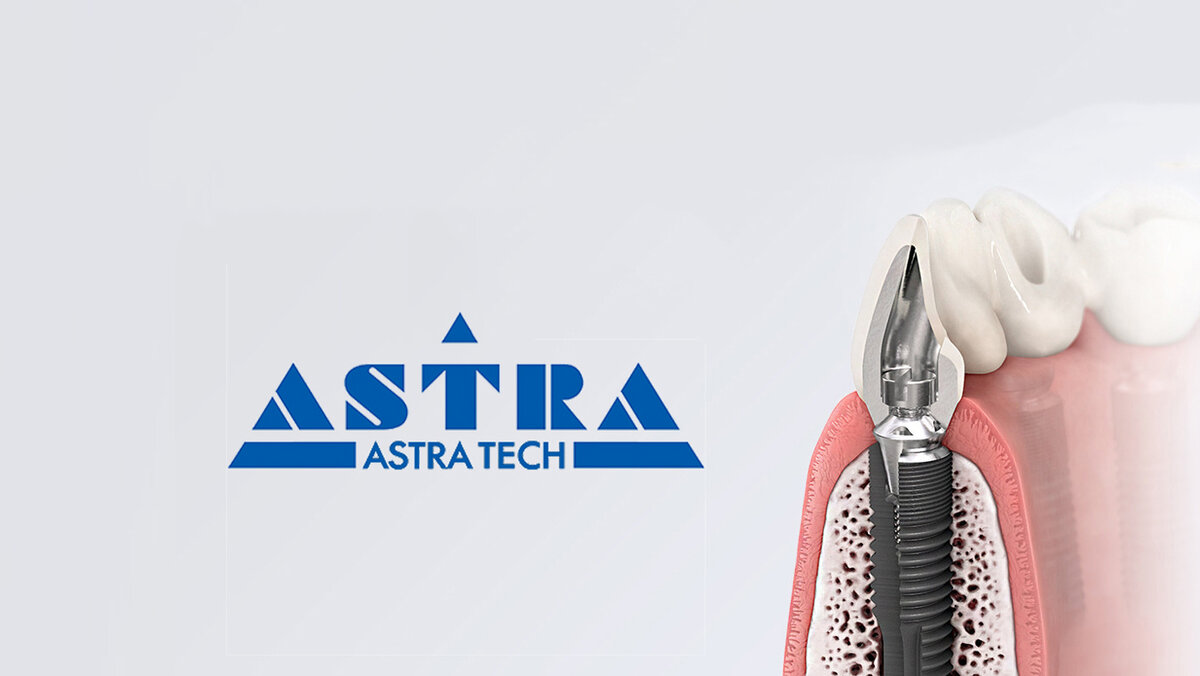 Спб стоматологии имплантации. Astra Tech формирователь 24574. Имплант Astra Tech. 2440 Astra Tech.