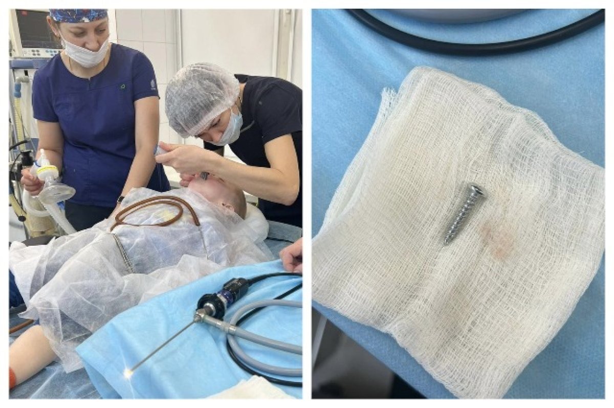    Тульские медики достали из горла двухлетнего ребенка саморез