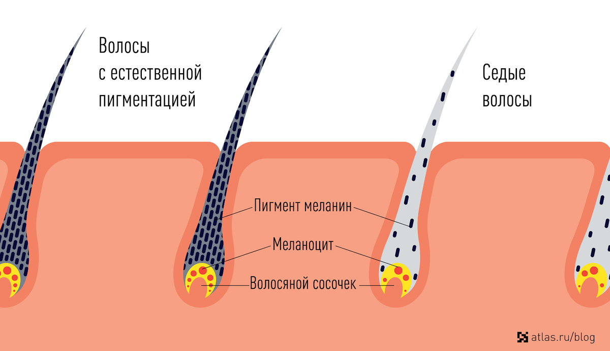 Меланоциты закачивают пигмент в стержень волоса, закрашивая его по всей длине. Когда количество клеток уменьшается, производство меланина сокращается, и волосы приобретают серебристый или белый оттенок.