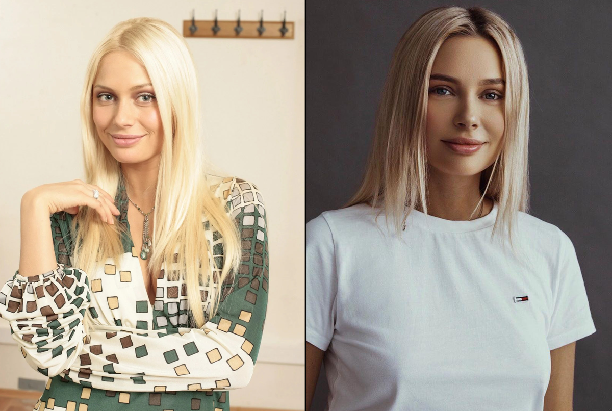 Рудова до и после пластики