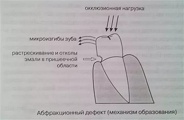 Как Нарисовать Зубную Щетку и Зубную Пасту - Раскраска и Рисование для Детей - Dailymotion Video