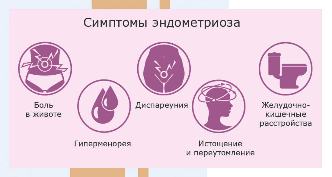 Основные симптомы эндометриоза именно такие (фото: https://altravita-ivf.ru/genitalnyij-endometrioz.html)
