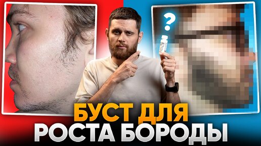 В 29 ЛЕТ НЕ РОСЛА БОРОДА / Результаты средства для роста бороды mr.Volos