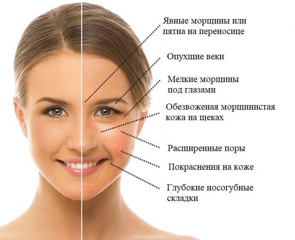 Многие пациенты сталкиваются с развитием отеков на лице, и во многих случаях это не только косметическая проблема.-2