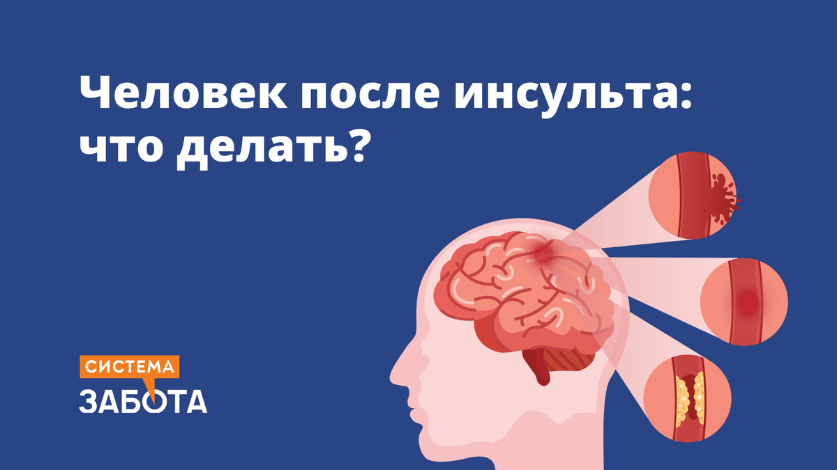 Человек после инсульта: что делать? 5 полезных статей | С заботой о пожилых  | Дзен