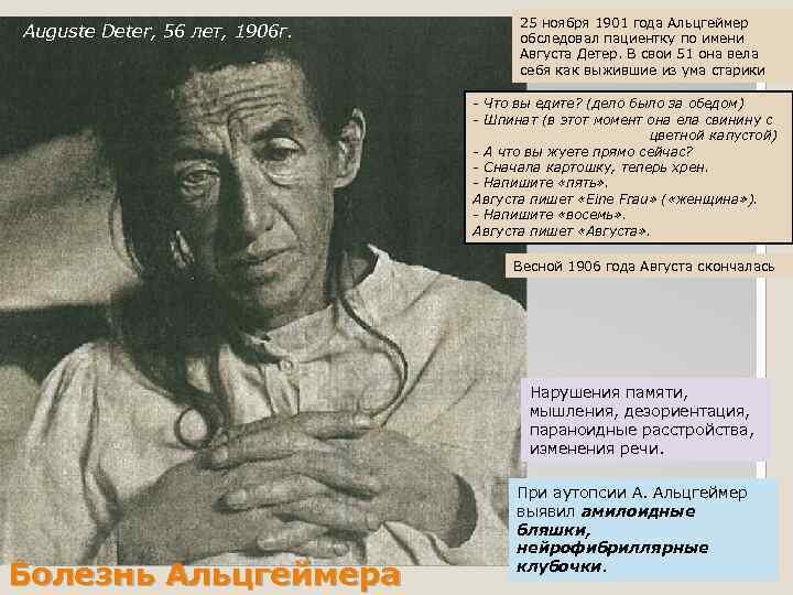 Свои выводы Алоис Альцгеймер сделал после многолетнего наблюдения за Августой Детер