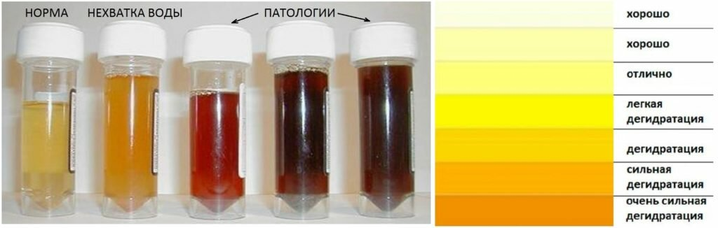 Нормальный цвет утренней мочи. Бесцветная моча. Черная моча при. Цвет мочи. Темный цвет мочи.