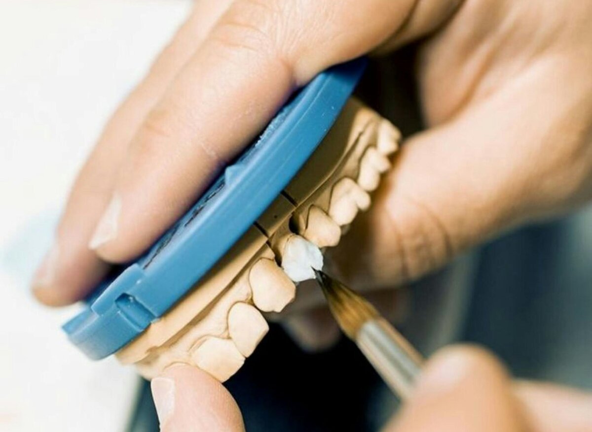   Скол на зубе происходит часто, поэтому многие из нас испытывали трудности, повреждая эмаль.