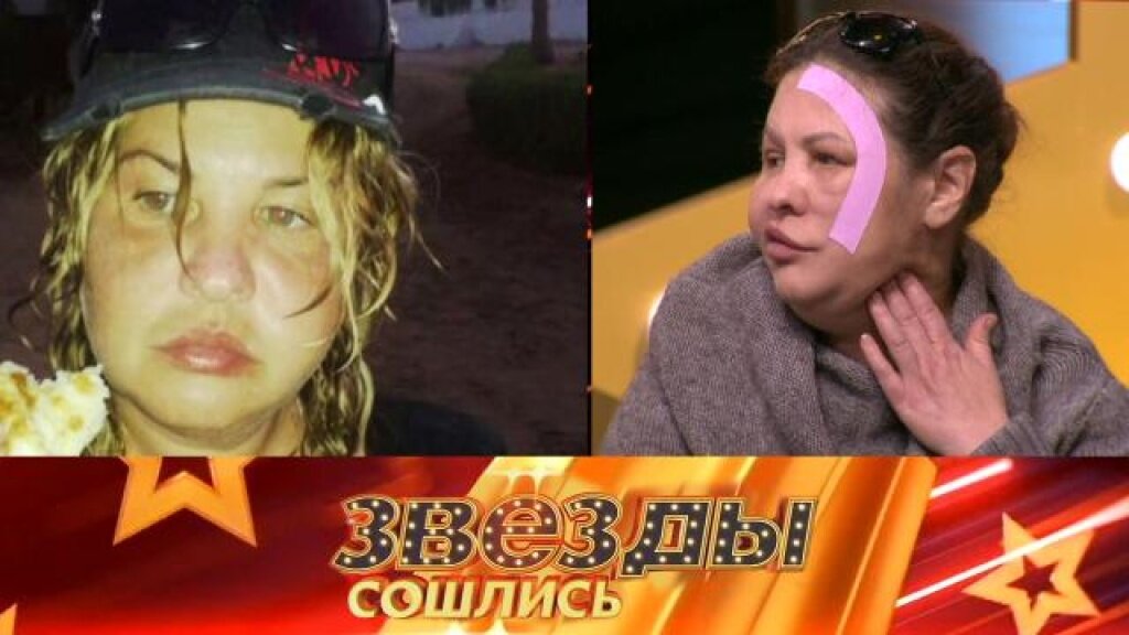    На игле красоты?