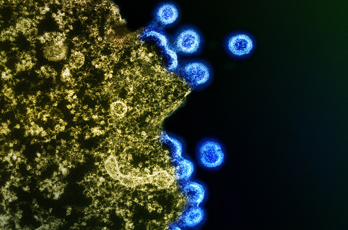 Можно ли вылечить ВИЧ-инфицированных детей? Новое исследование внушает ...