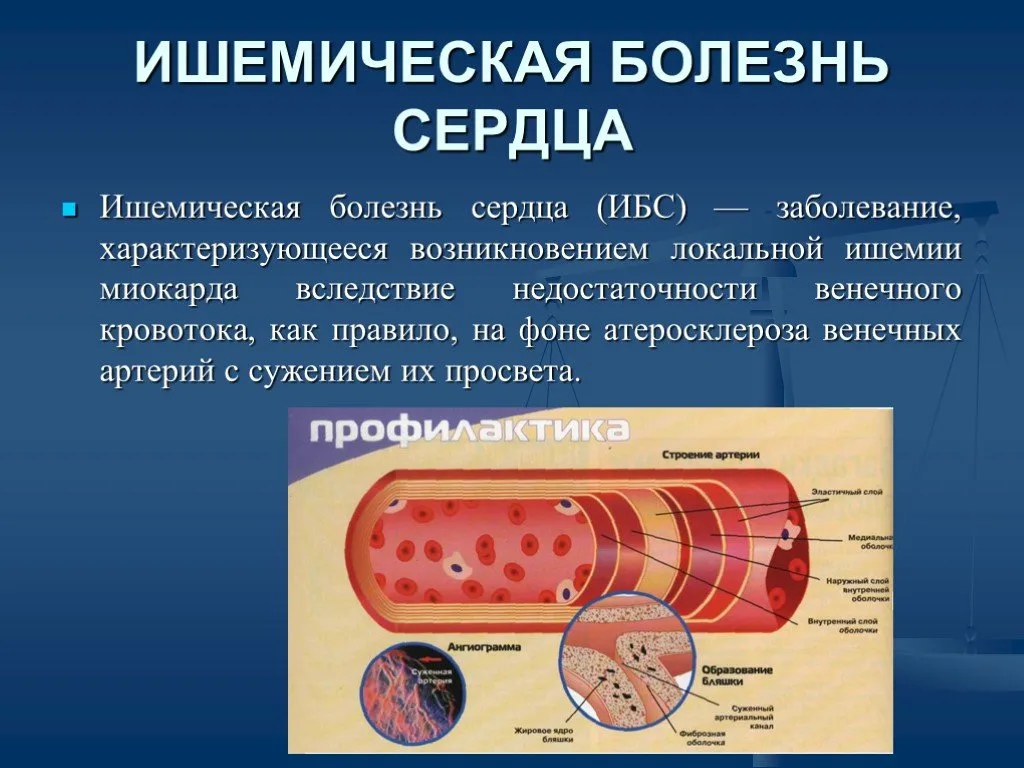 Ишемия что принимать