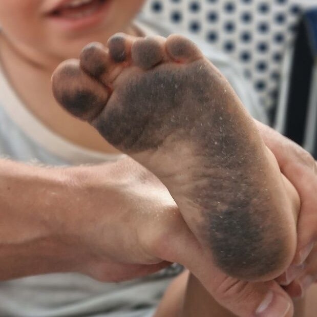 Стопа моего младшего сына. Каждый пальчик участвует в шаге.