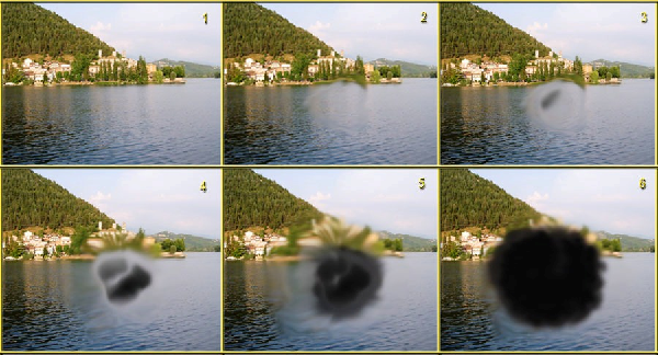 Стадии прогрессирования макулодистрофии