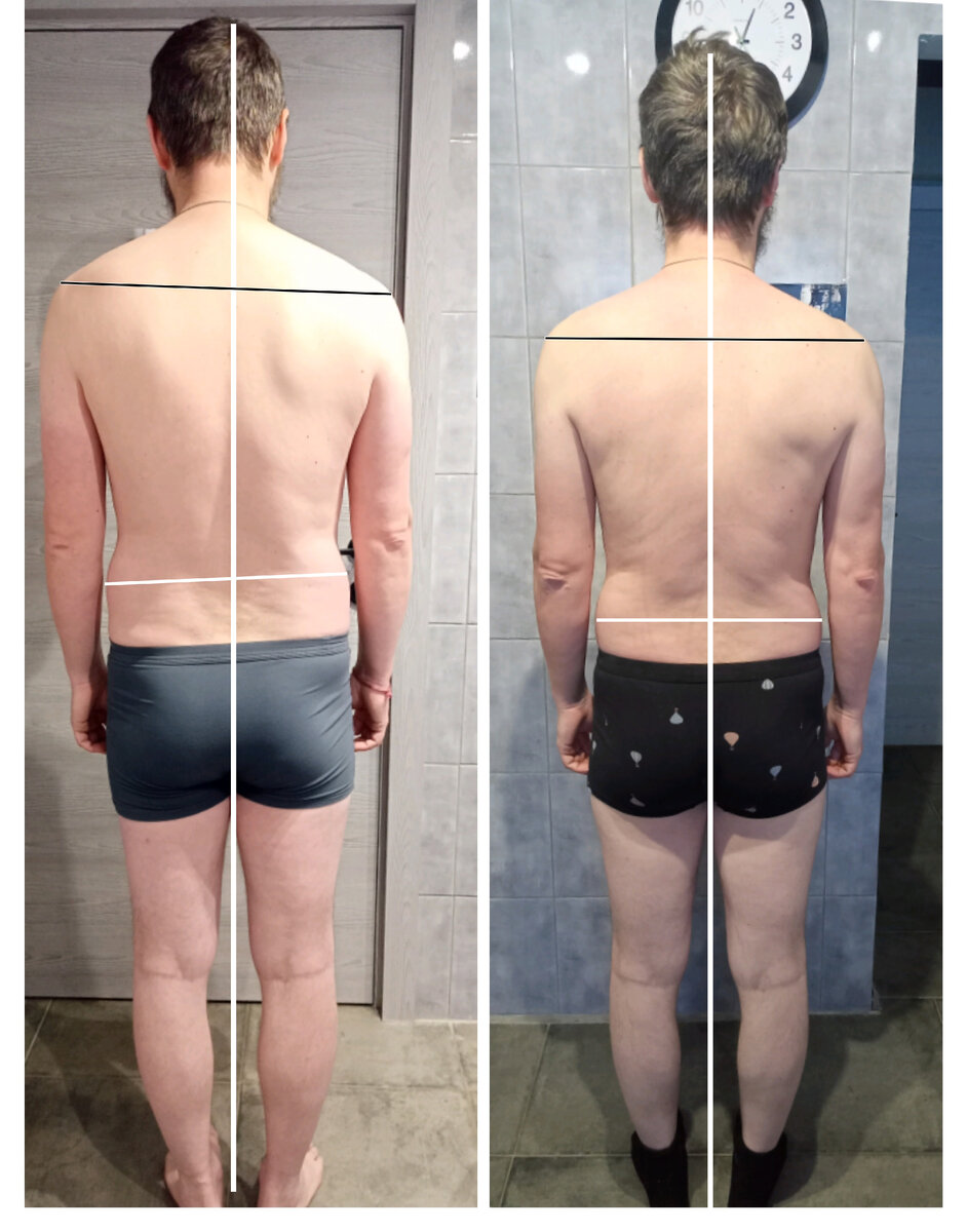 Вот пример толстокожего человека — крупное тело и такая же крупная и устойчивая центральная и периферическая нервная системы. Для таких людей подойдут такие способы помощи, которые не подойдут тонкокожим.