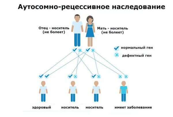 Наследственное заболевание фенилкетонурия.