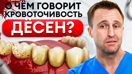 Как убрать кровоточивость десен?! Кровь из десны – верный признак ЭТОГО заболевания!