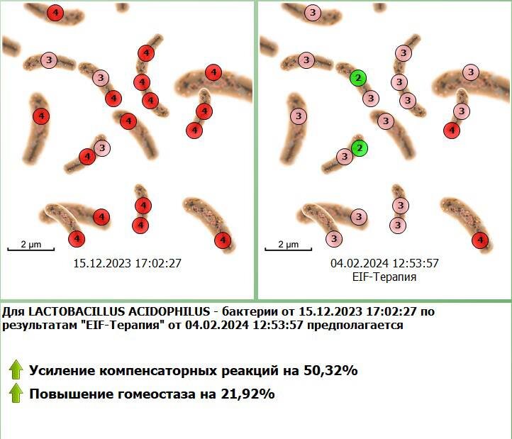 Антипаразитарная программа для подростка | Зеркала Козырева. Центр ...