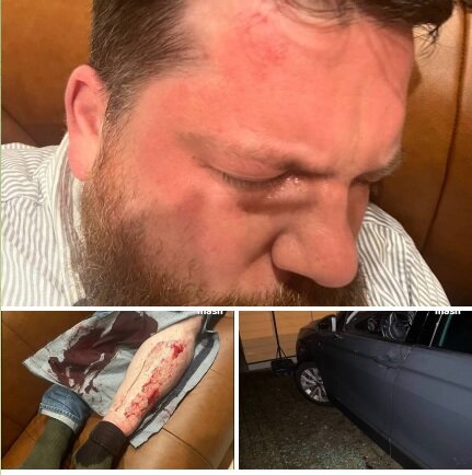    "Фотодоказательства" нападения на Волкова*