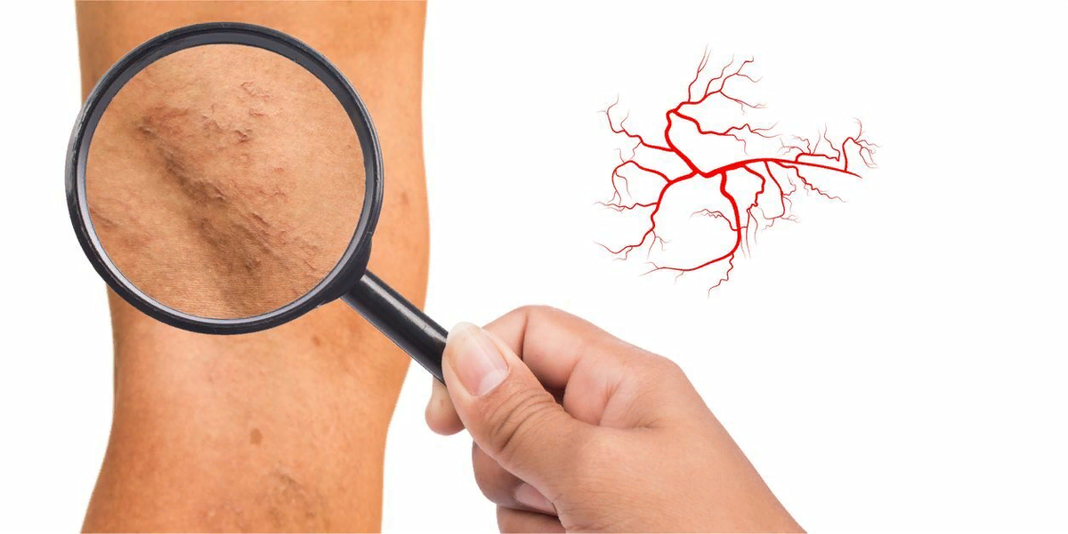 Яндекс.Картинки