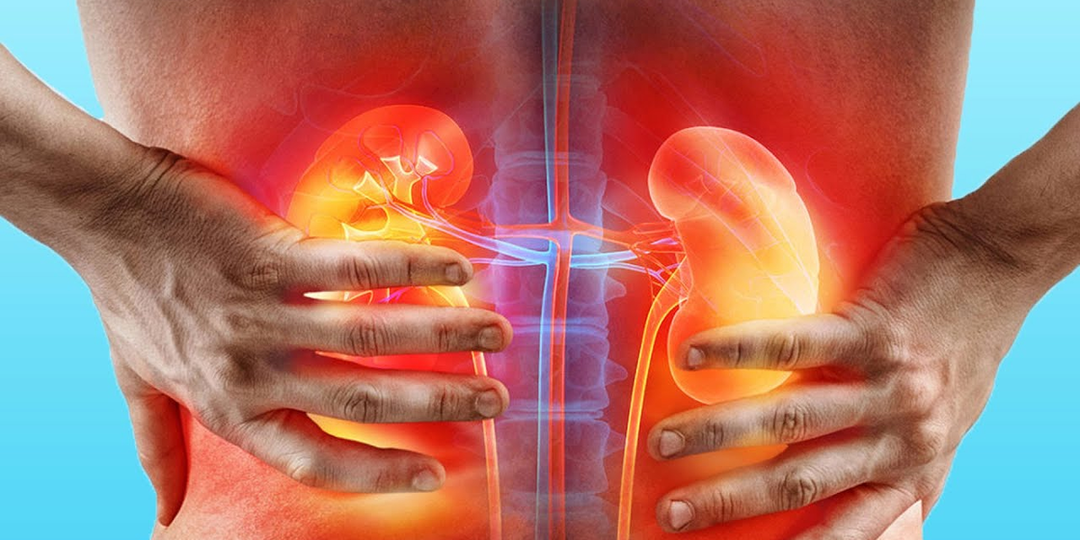 Врач уточнила, как болят почки при гломерулонефрите: причины и устранение воспаления
