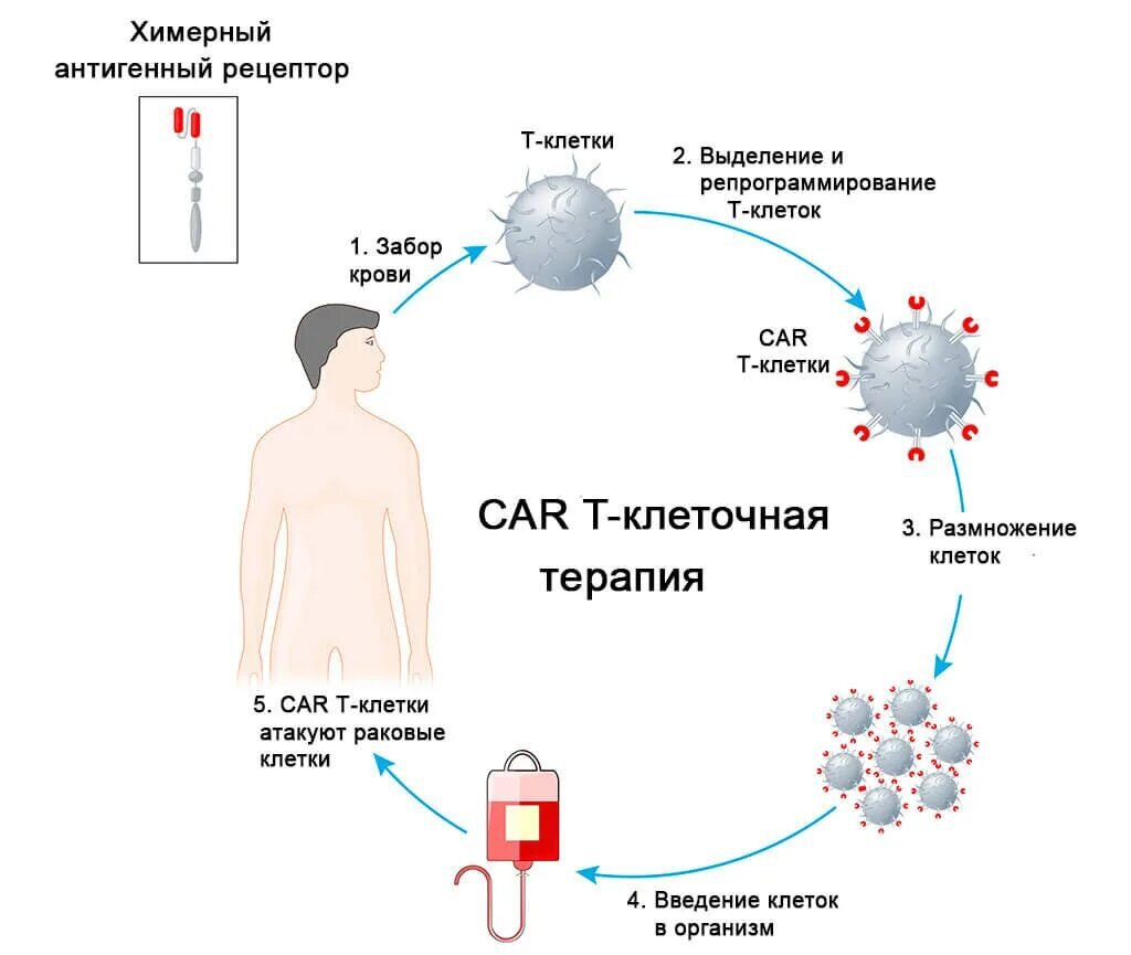 CAR-T терапия рака