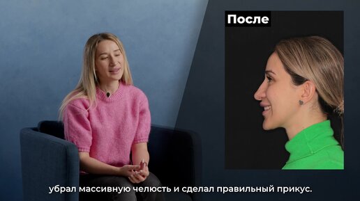 Как исправить большую челюсть? До и после ортогнатической операции.