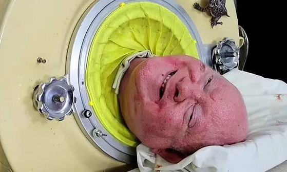 ПОЛ АЛЕКСАНДР ПРОВЕЛ В КАПСУЛЕ 72 ГОДА. ФОТО: DAILYMAIL.CO.UK