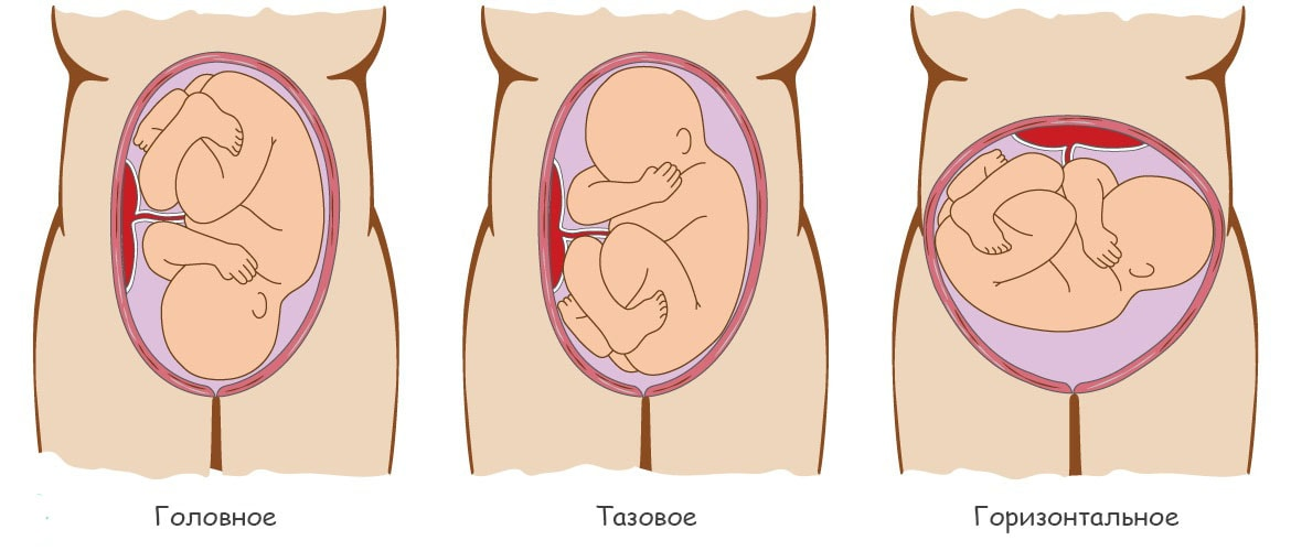 Как определить расположение ребенка