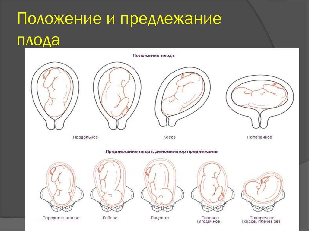 Продольное головное.