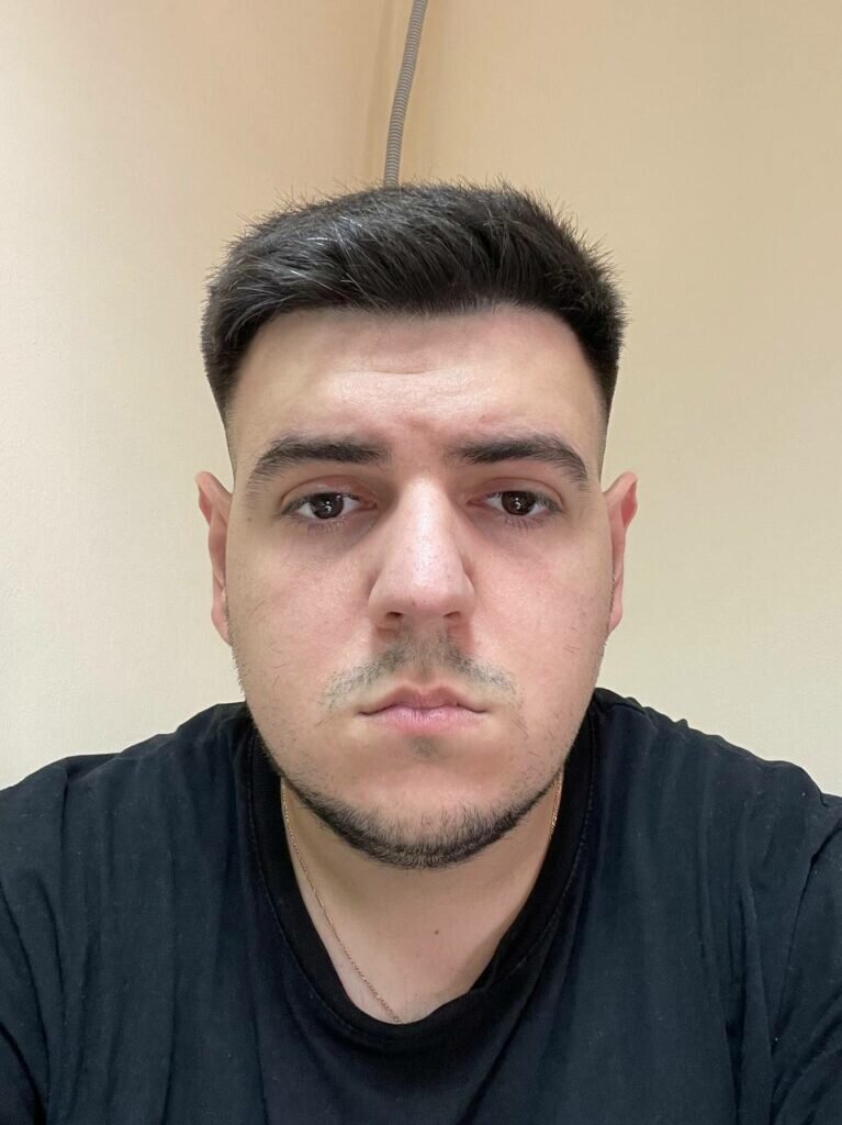 -2