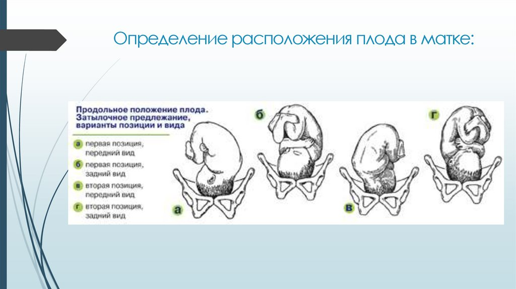 Предлежание, позиция и положение плода (включая ягодичное предлежание плода)