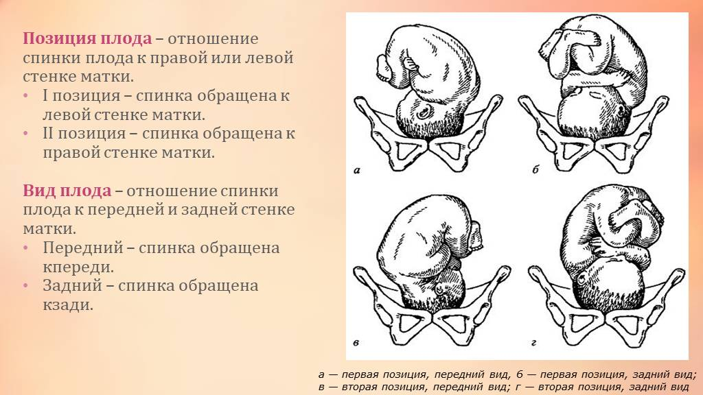 Головное предлежание плода: виды, позиции, положения