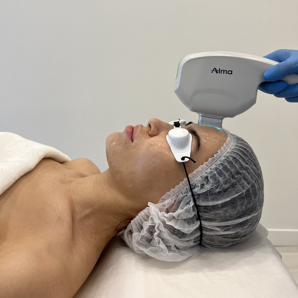 Фотоомоложение кожи лица в сети клиник косметологии GEN87