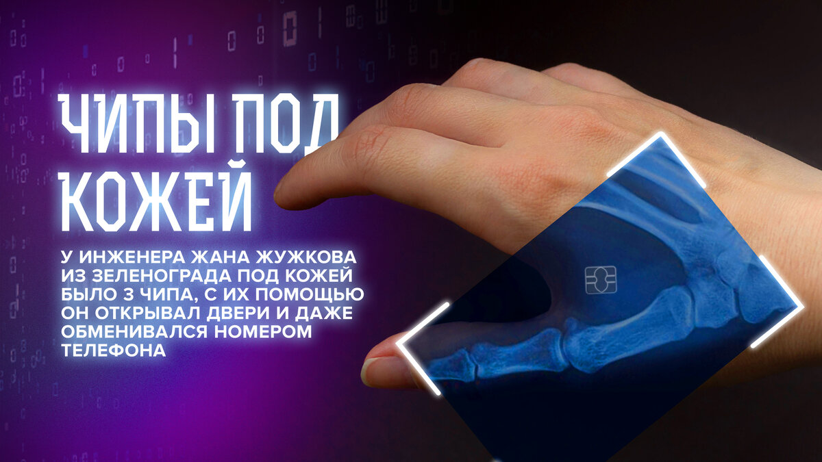 День Х настал: как далеко зашло чипирование? | «Капитаны будущего» |  энциклопедия завтраведения | Дзен