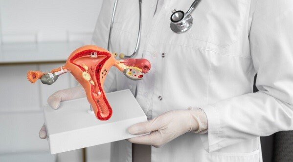 Причиной развития рака шейки матки является вирус папилломы человека