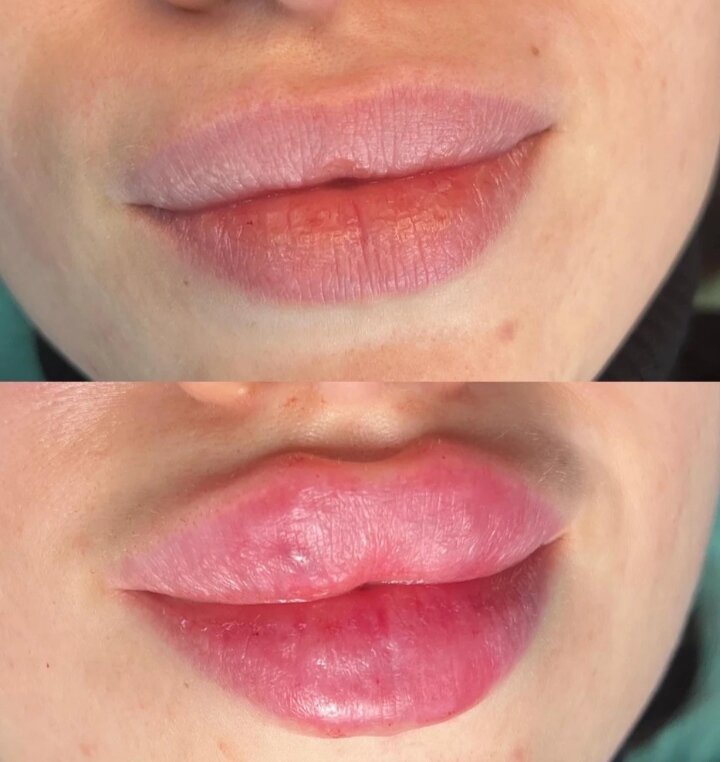 Фото с маркетплейса, девушка написала отзыв, довольна результатом и хвастается, а вам как её самолелка?