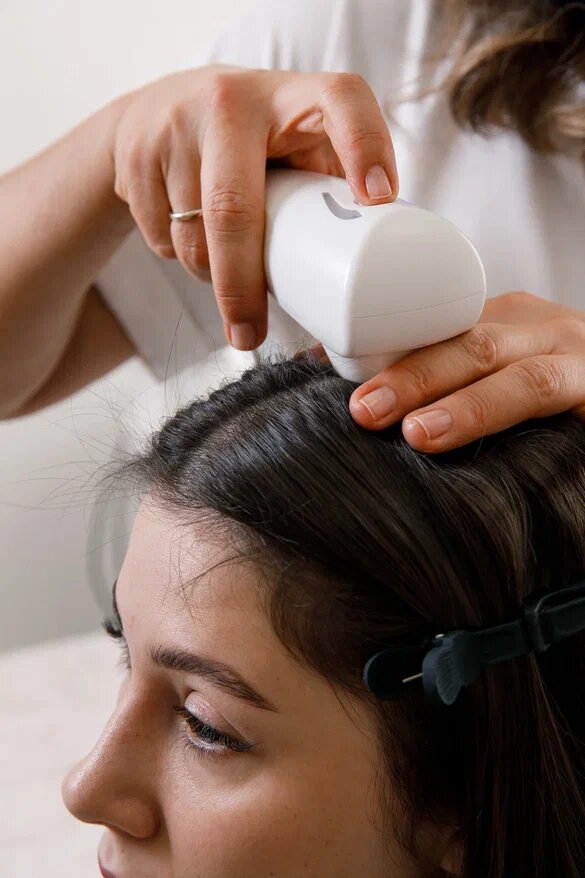 Лечение перхоти и выпадения волос