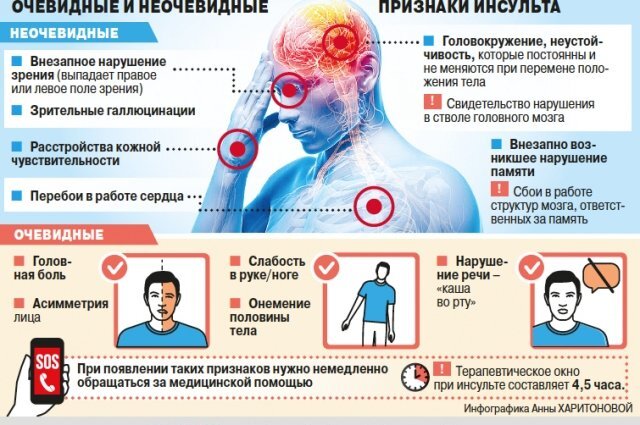    Признаки инсульта.