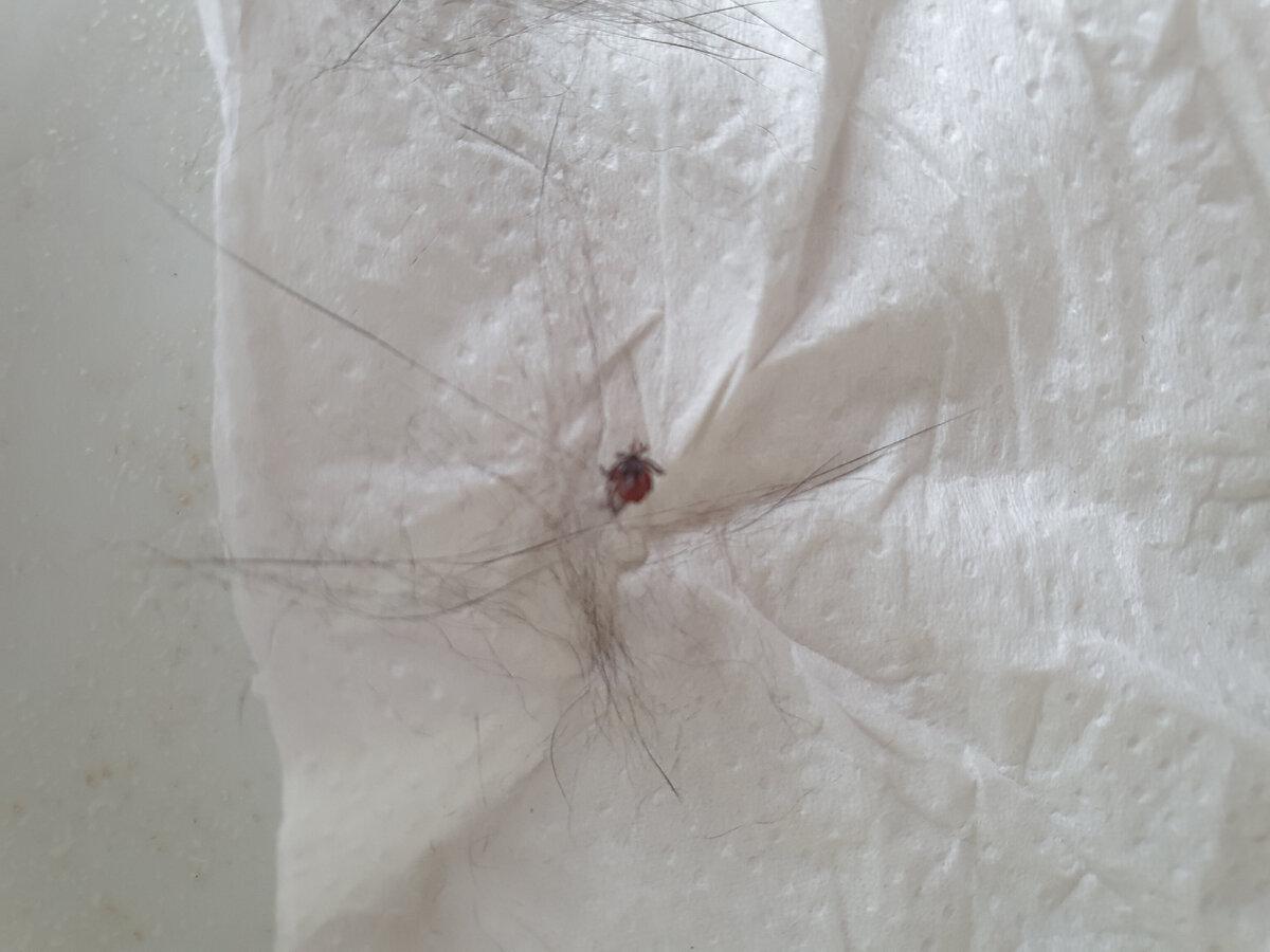 Клещ, фото личное, клещ лесной)))