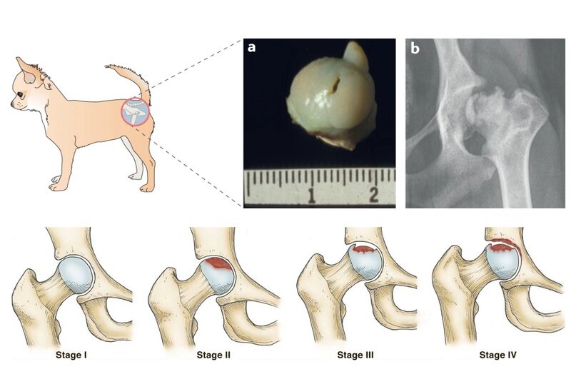 Стадии болезни Легга-Кальве-Пертеса