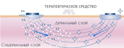 Гальваника в косметологии