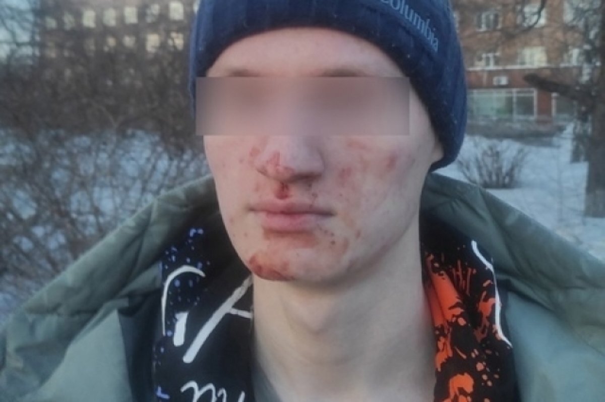    Молодые люди избили 17-летнего школьника в Нижнем Тагиле
