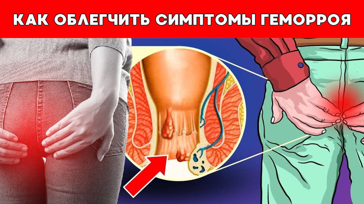 Осложненный геморрой карта вызова