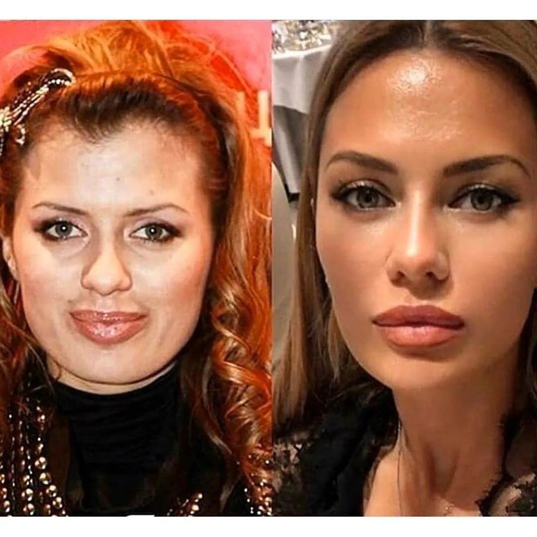 Виктория до пластики фото