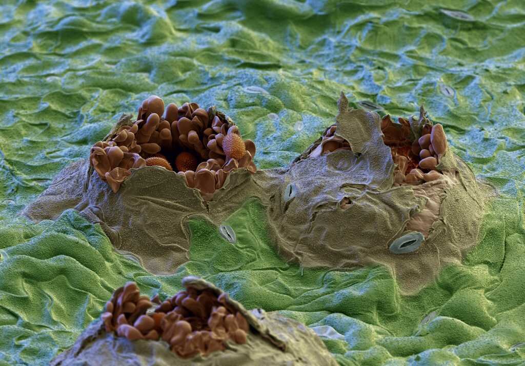 Грибок стопы