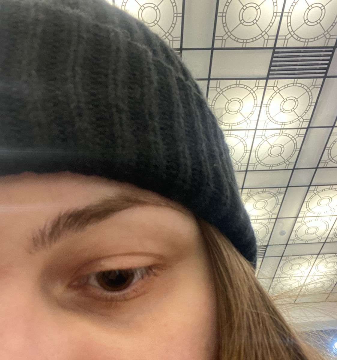 Действие специальных капель, которые расширяют зрачки, чтобы врач мог осмотреть внутреннюю часть глаза