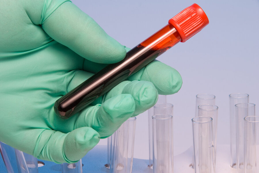     Диета при диабете и повышенном уровне сахара в крови