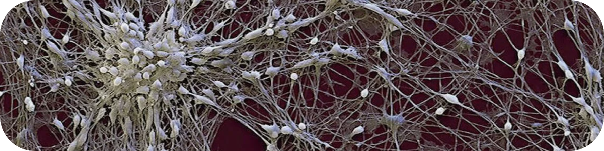 Нейроны мозга под микроскопом